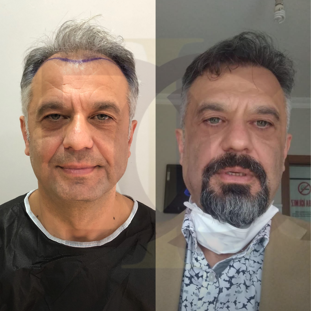 20230611_182520000_iOS 1