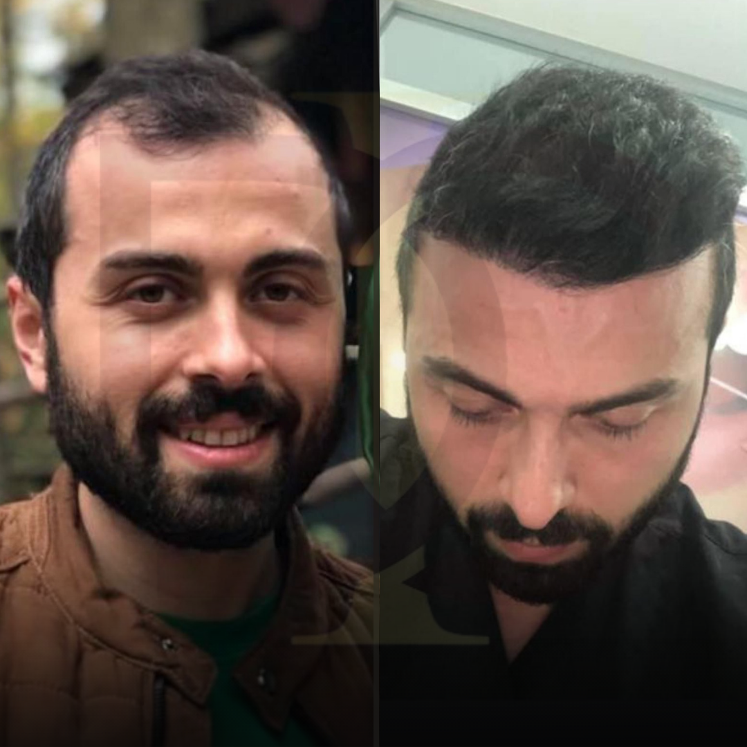 20230611_182520000_iOS 10