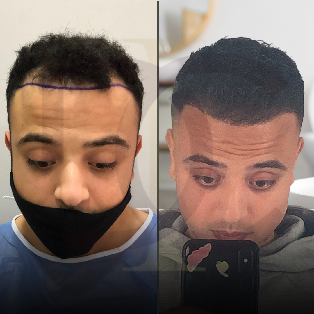 20230611_182520000_iOS 11