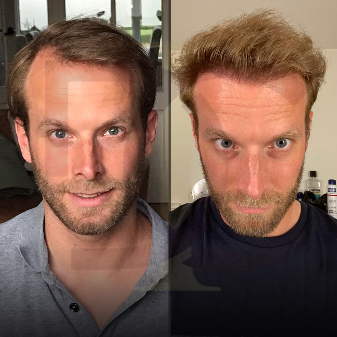 20230611_182520000_iOS 12