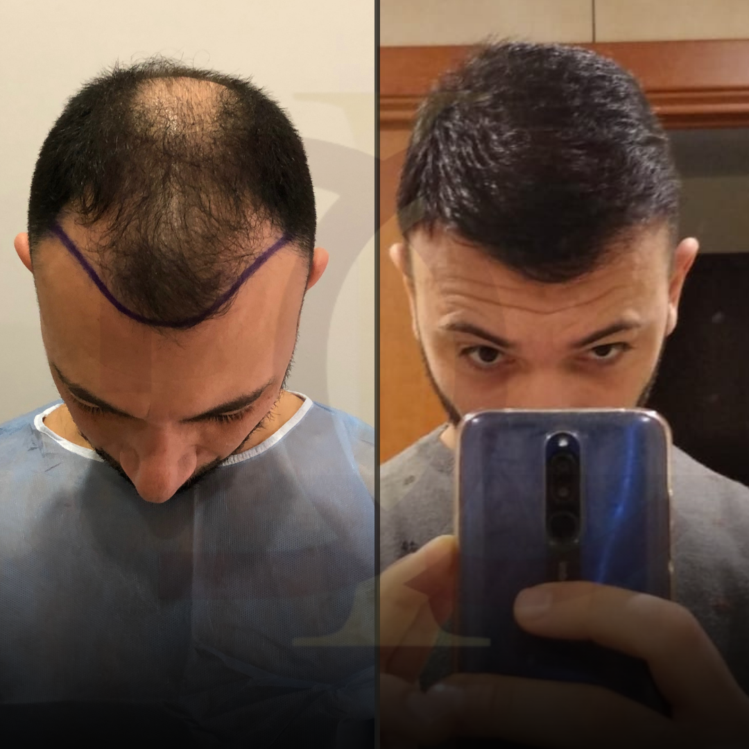 20230611_182520000_iOS 14