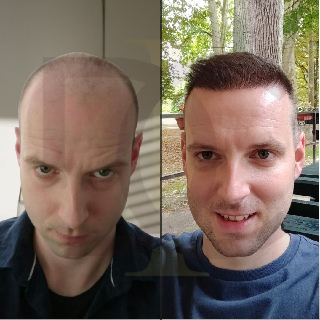 20230611_182520000_iOS 15