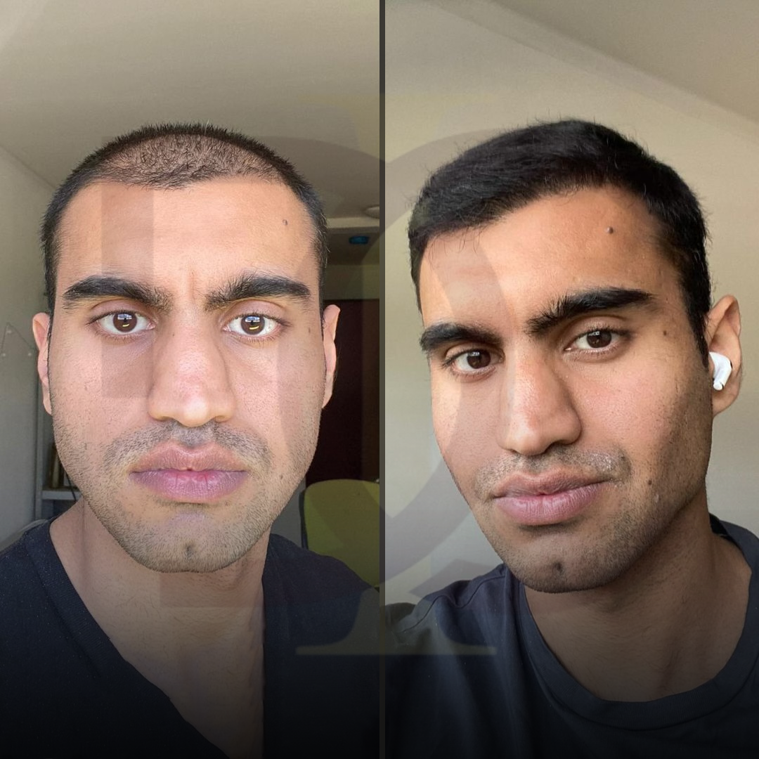 20230611_182520000_iOS 16