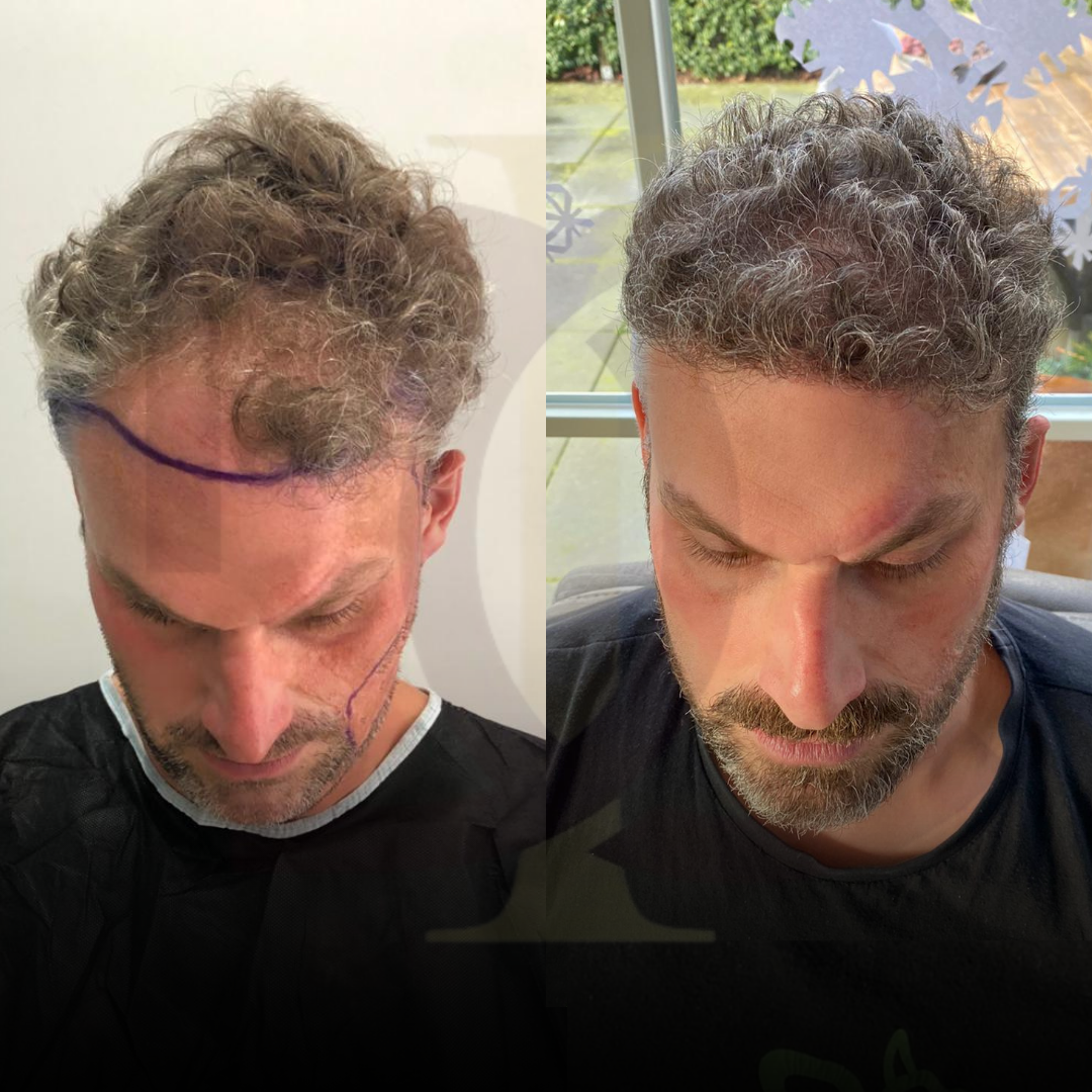 20230611_182520000_iOS 18