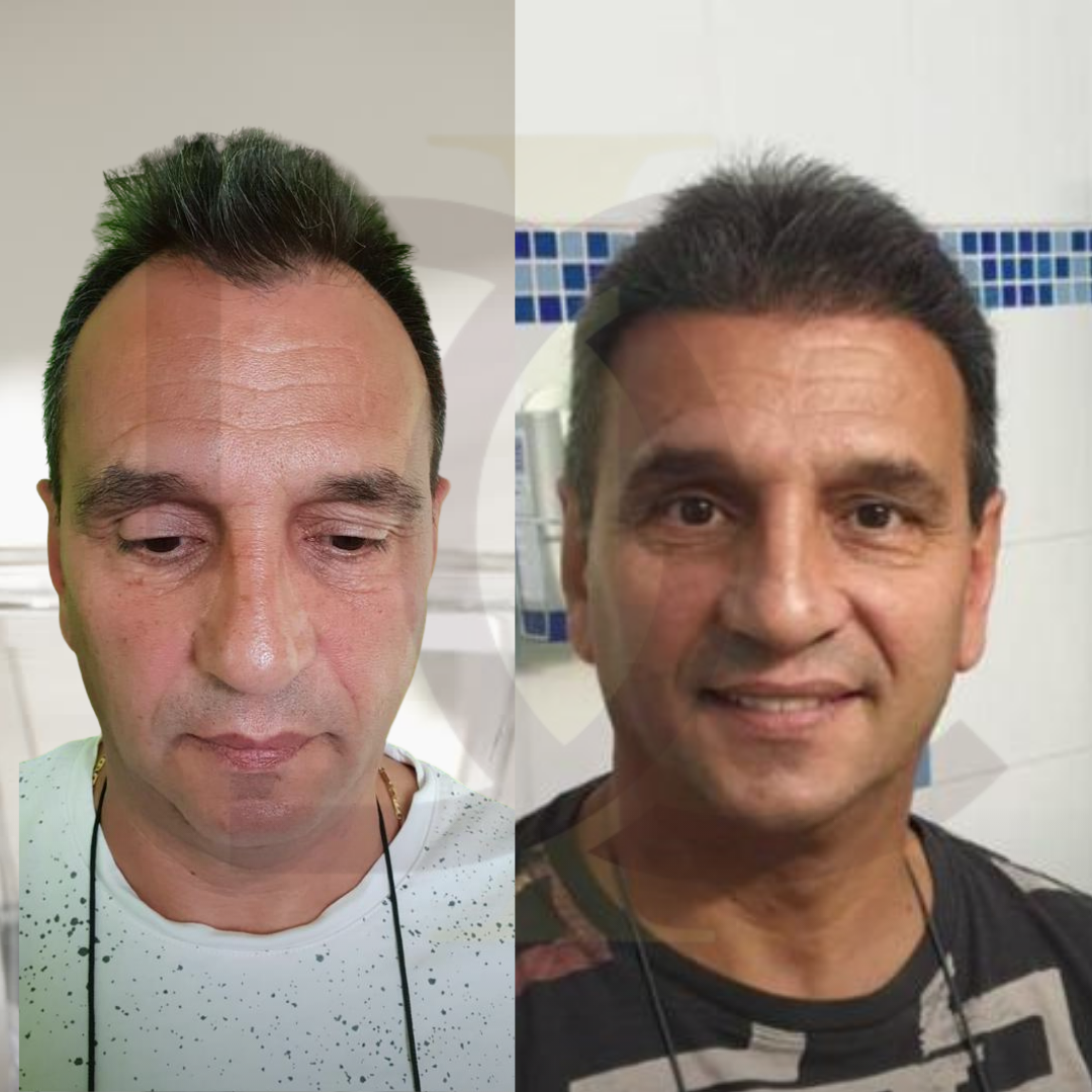 20230611_182520000_iOS 19