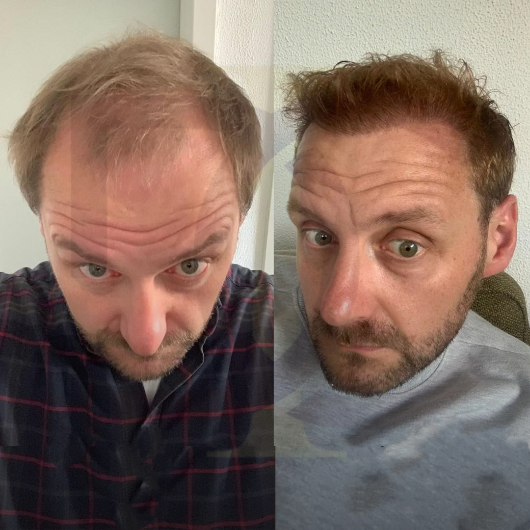 20230611_182520000_iOS 2