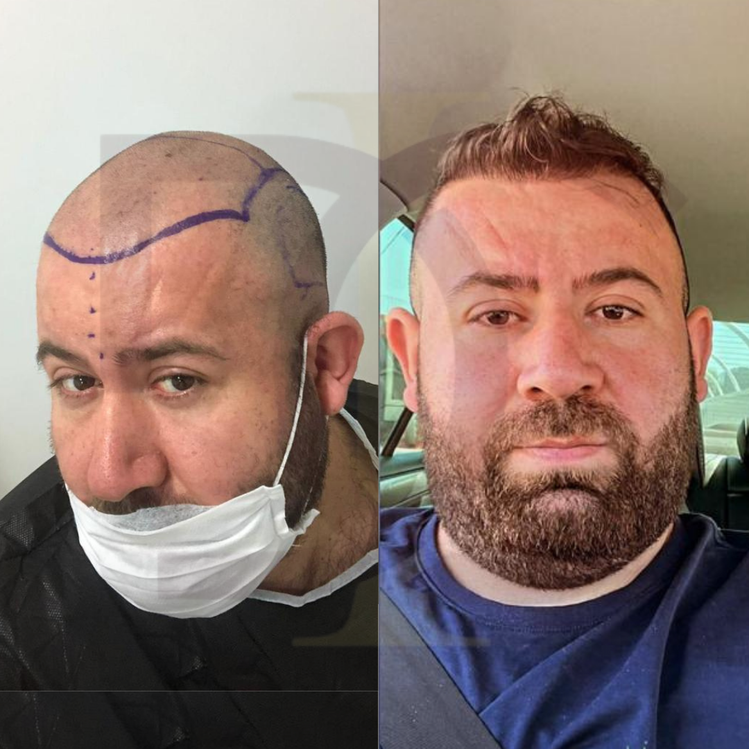 20230611_182520000_iOS 3