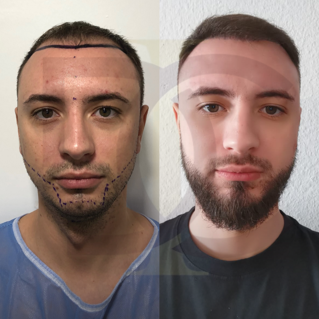 20230611_182520000_iOS 4