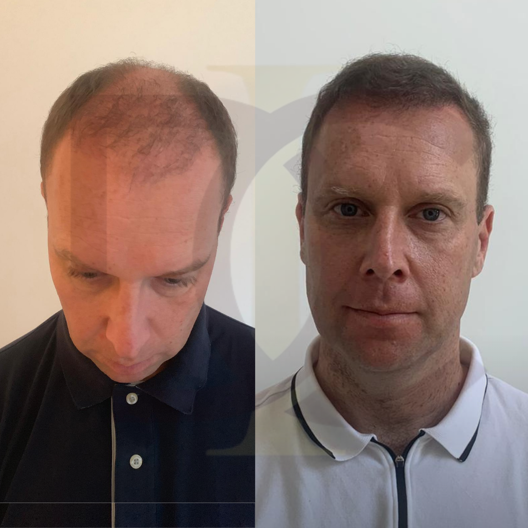 20230611_182520000_iOS 5