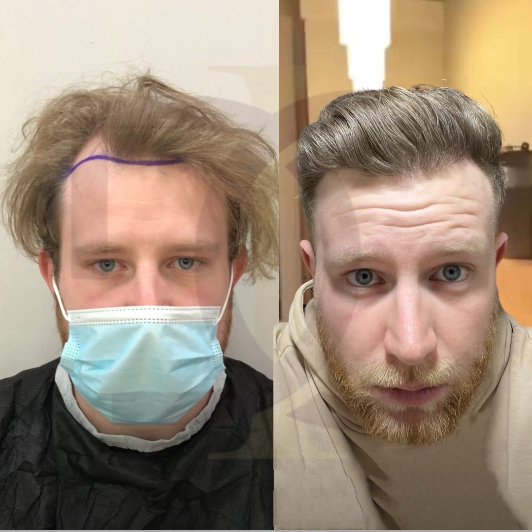 20230611_182520000_iOS 6