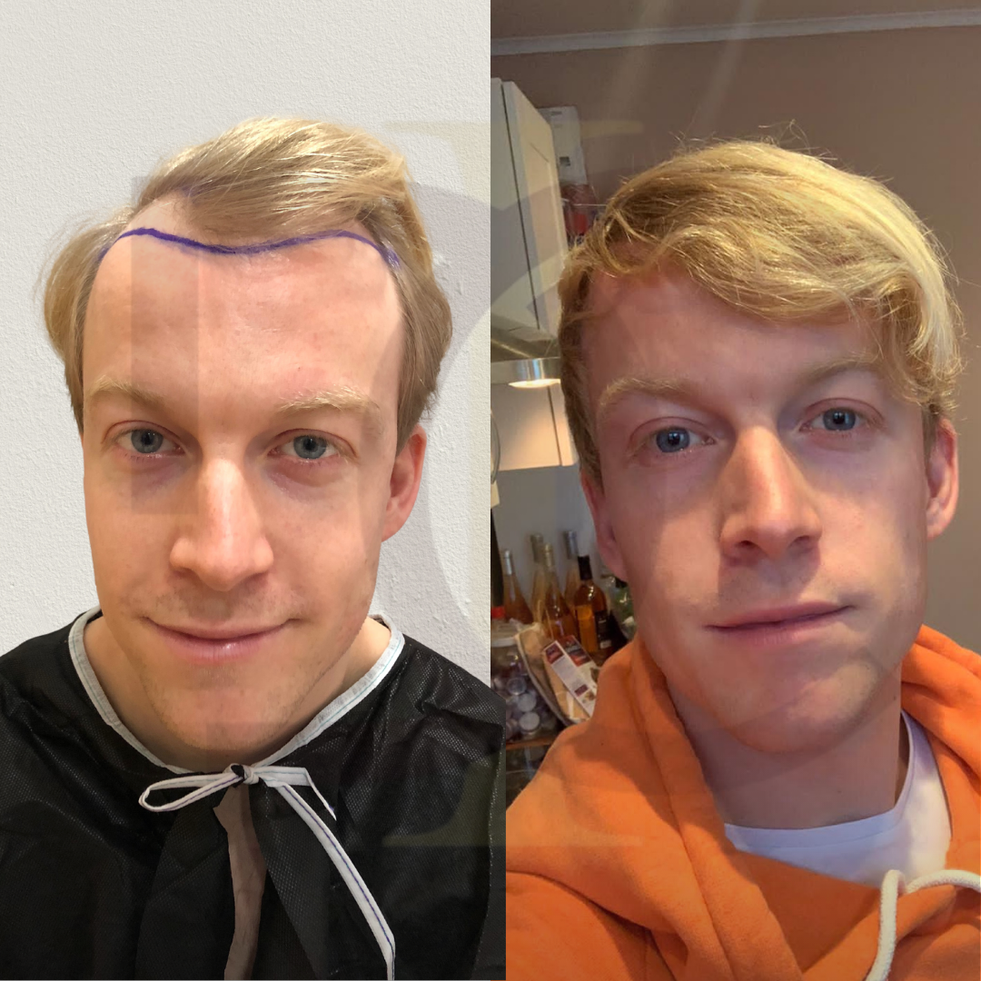 20230611_182520000_iOS 7