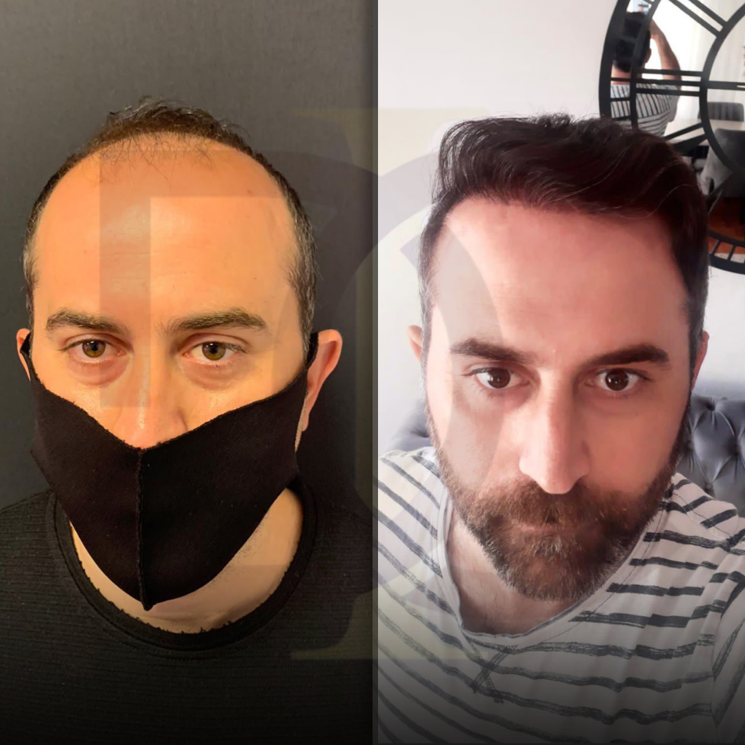 20230611_182520000_iOS 9