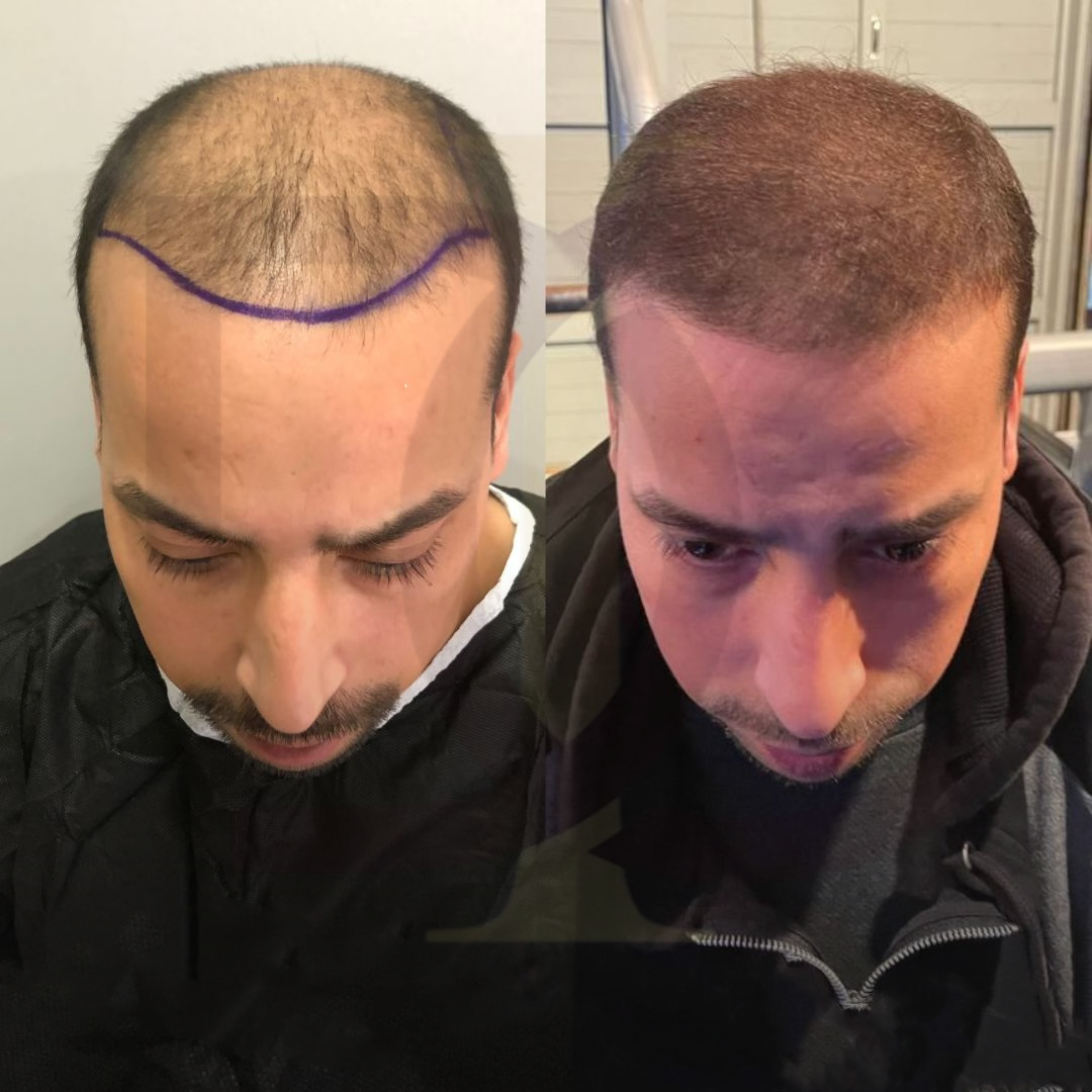 20230611_182520000_iOS