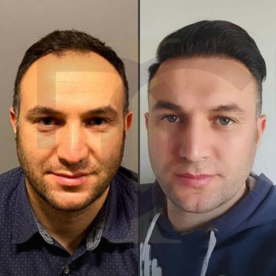 8 mart kadınlar günü (1)