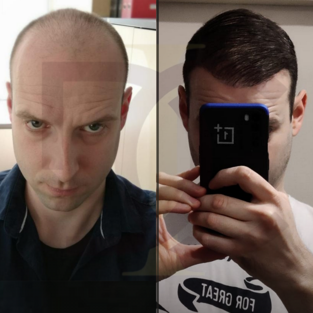 8 mart kadınlar günü (3)