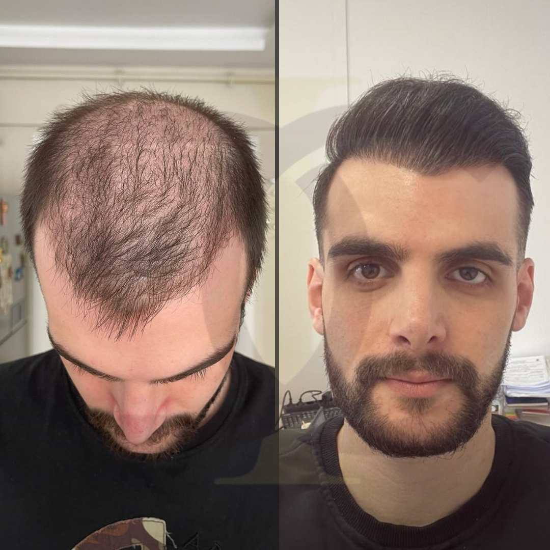 8 mart kadınlar günü