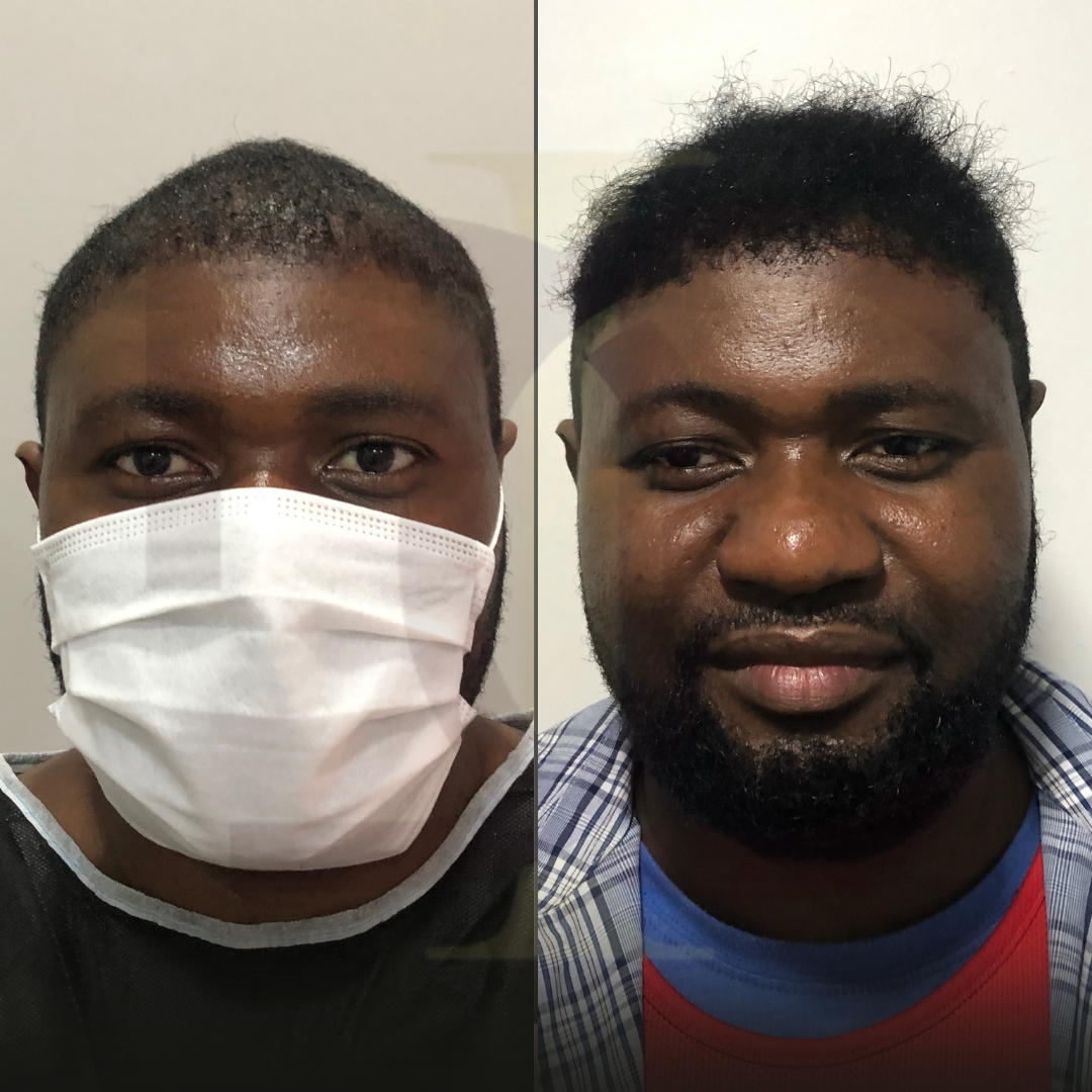 Copy of BEFORE (Instagram Gönderisi (Kare)) Kopyası Kopyası Kopyası Kopyası