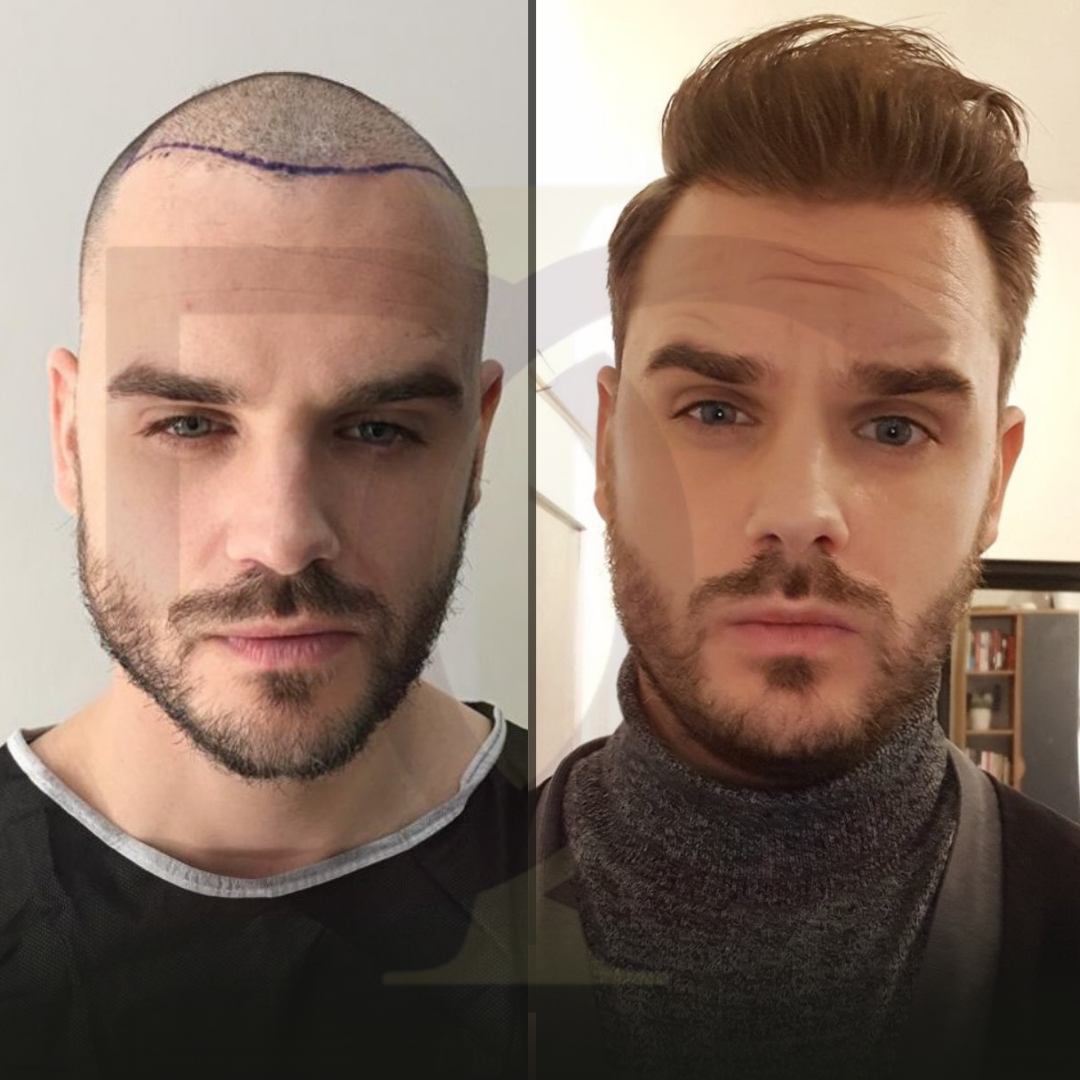 Kopie van BEFORE (Instagram Gönderisi (Kare)) Kopyası Kopyası