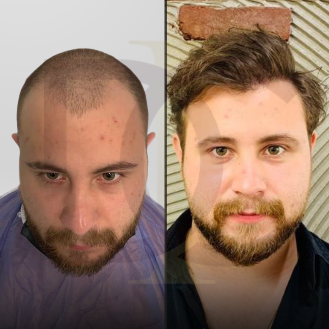 Sarı Profesyonel Gradyanlar Uygulama Geliştirme Instagram Gönderisi Kopyası (1)